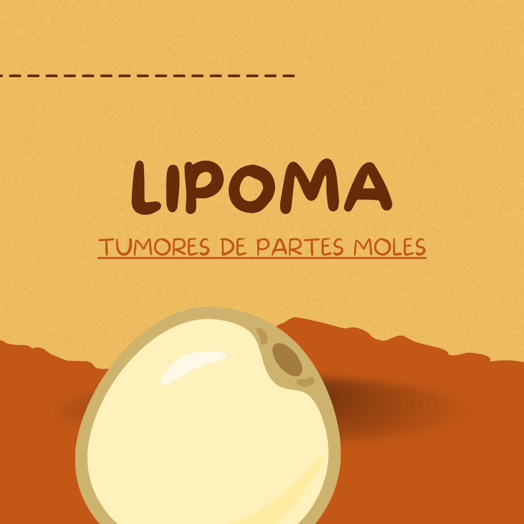 Patologia de partes moles: Lipoma