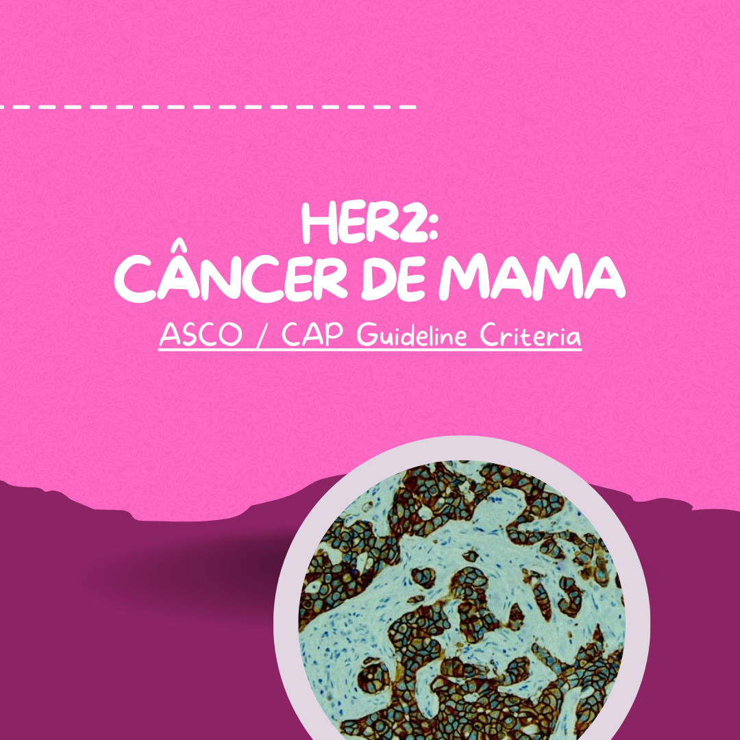 HER2 no Câncer de Mama